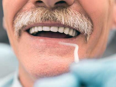 older man getting a dental cleaning
