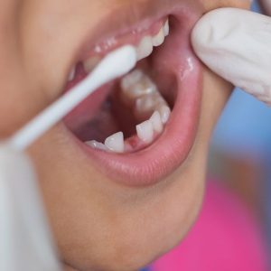 little kid getting a dental cleaning